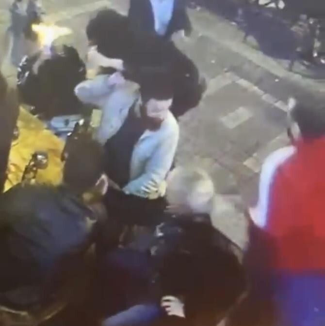 Kadıköy'de dehşet anlarının görüntüsü ortaya çıktı: Genç kadının yüzünü böyle yaktı!