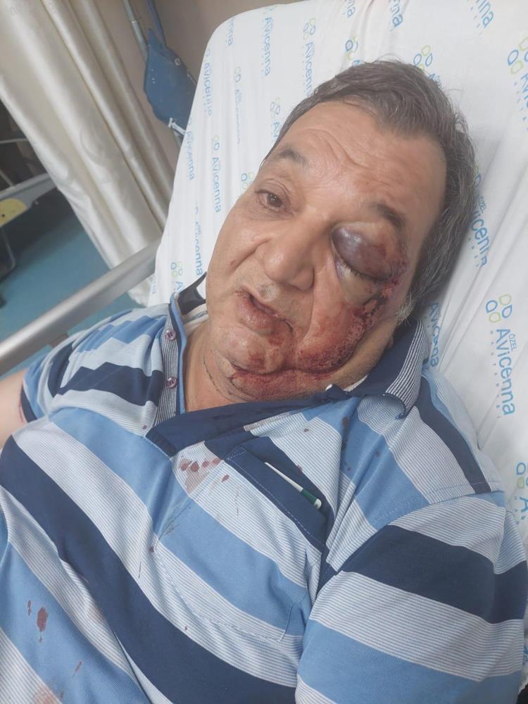 Bahçelievler’de yol verme tartışmasında taksici ağır yaralandı!