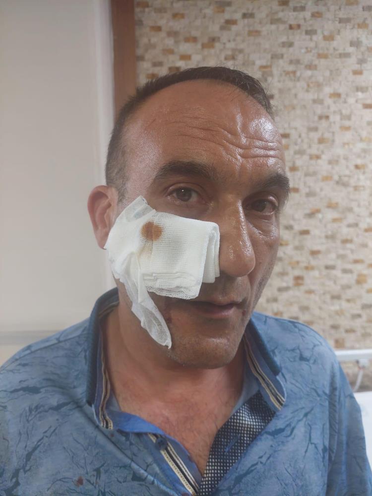 Bahçelievler’de yol verme tartışmasında taksici ağır yaralandı!