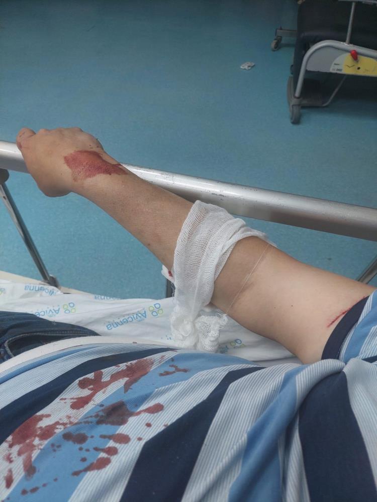 Bahçelievler’de yol verme tartışmasında taksici ağır yaralandı!